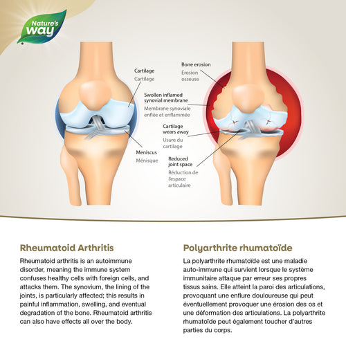 NutraSea® Arthritis Targeted Omega-3, Citrus Flavour / 6.8 fl oz (200 ml)